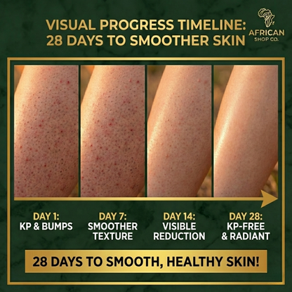 African Keratosis Pilaris Transformation Kit™