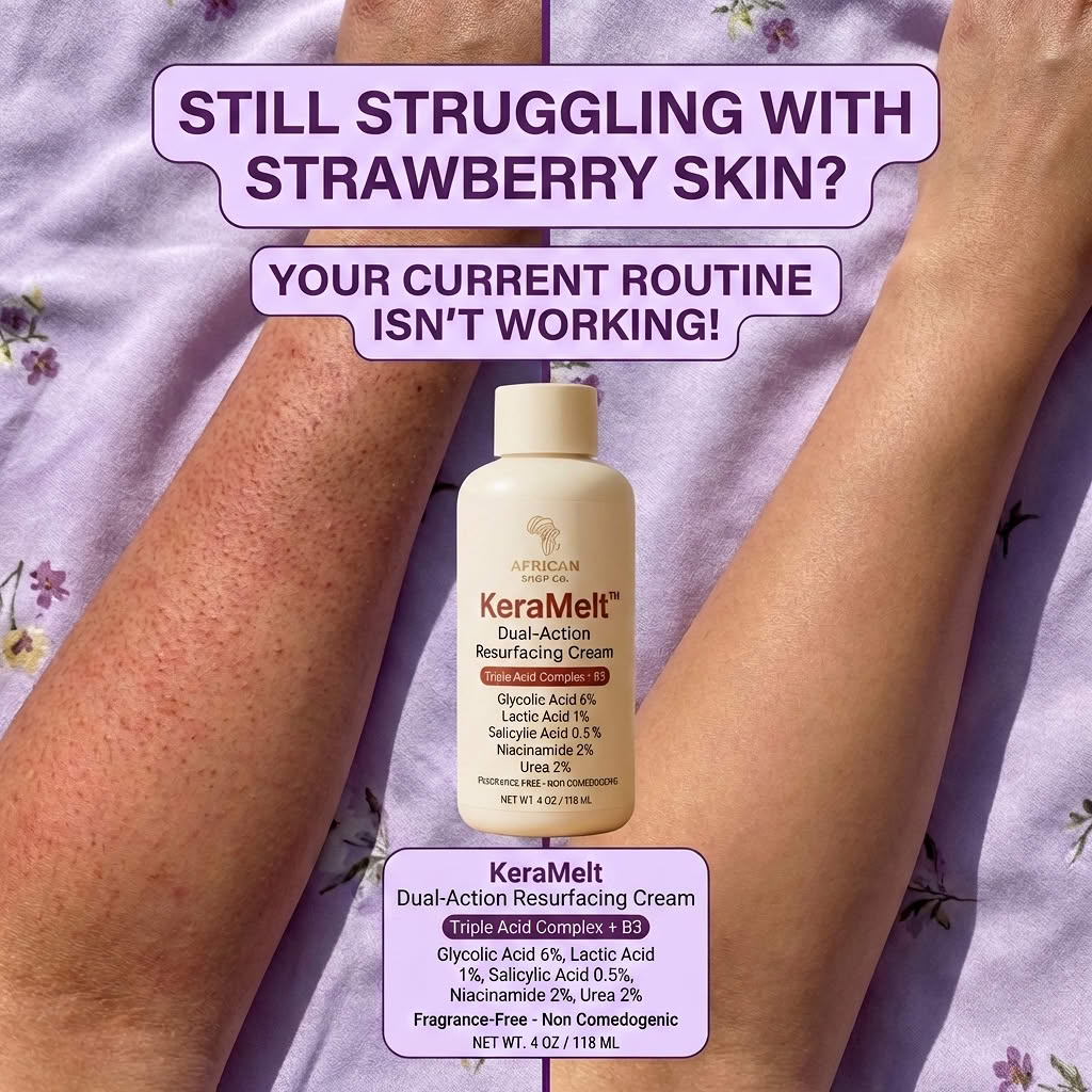 KeraMelt™ Gentle Triple-Acid Keratosis Pilaris Cream