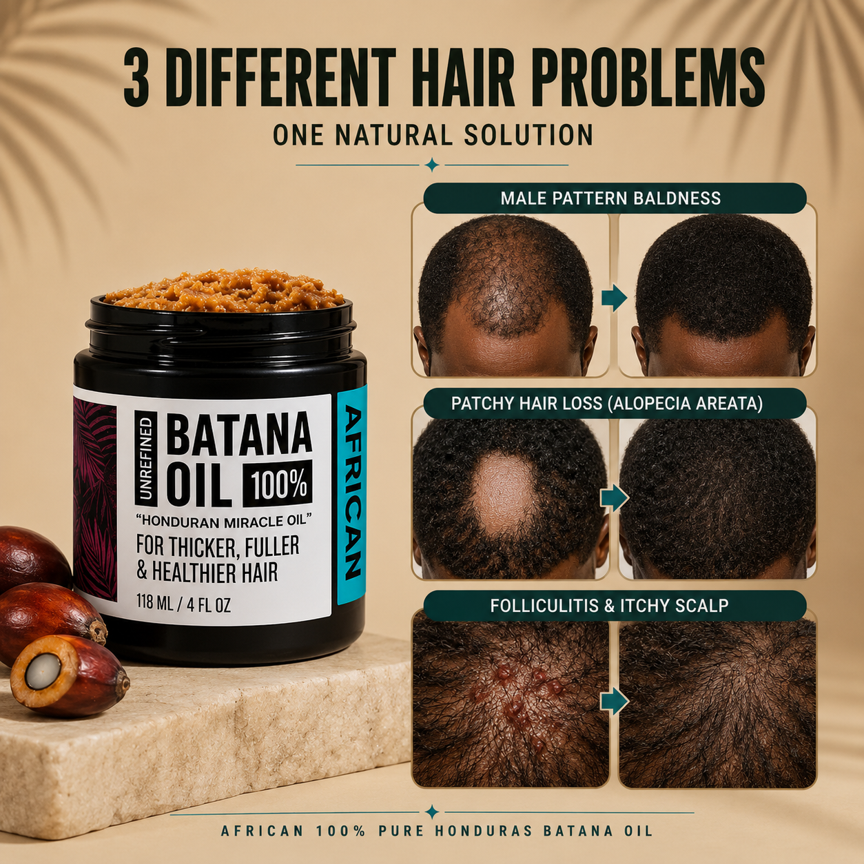 Batana Natural Hair Growth Oil