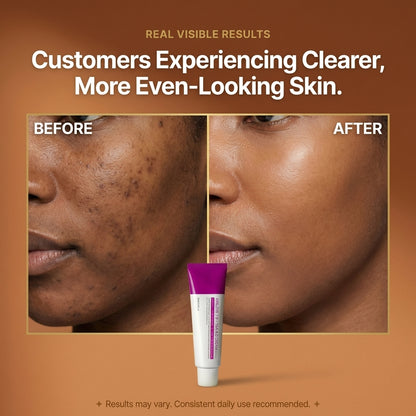 Alpha Arbutin + TXA Cream